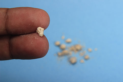very small kidney stone