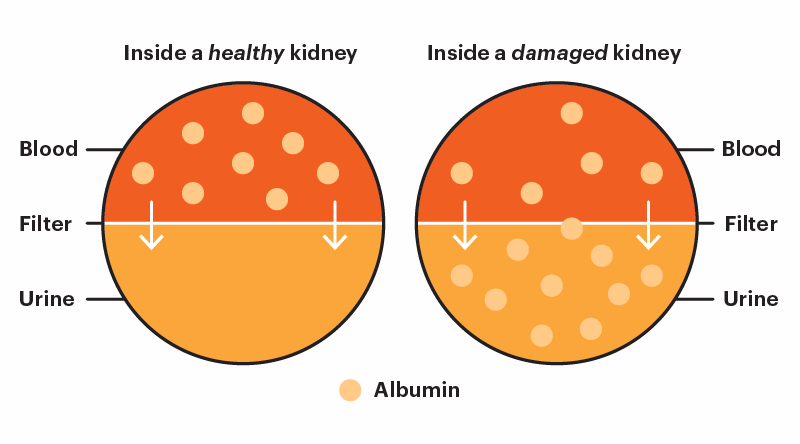 Albuminuria