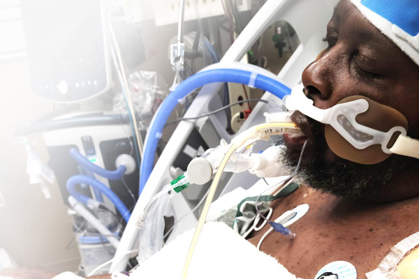Darwin in hospital with breathing tubes.