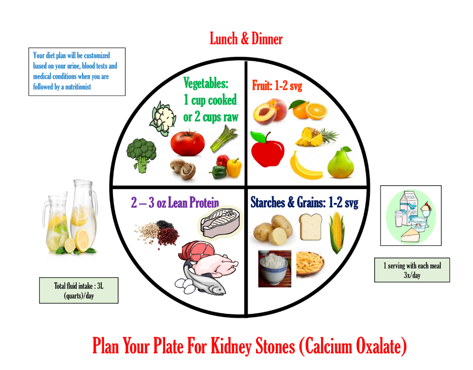 Plan Your Plate For Kidney Stones