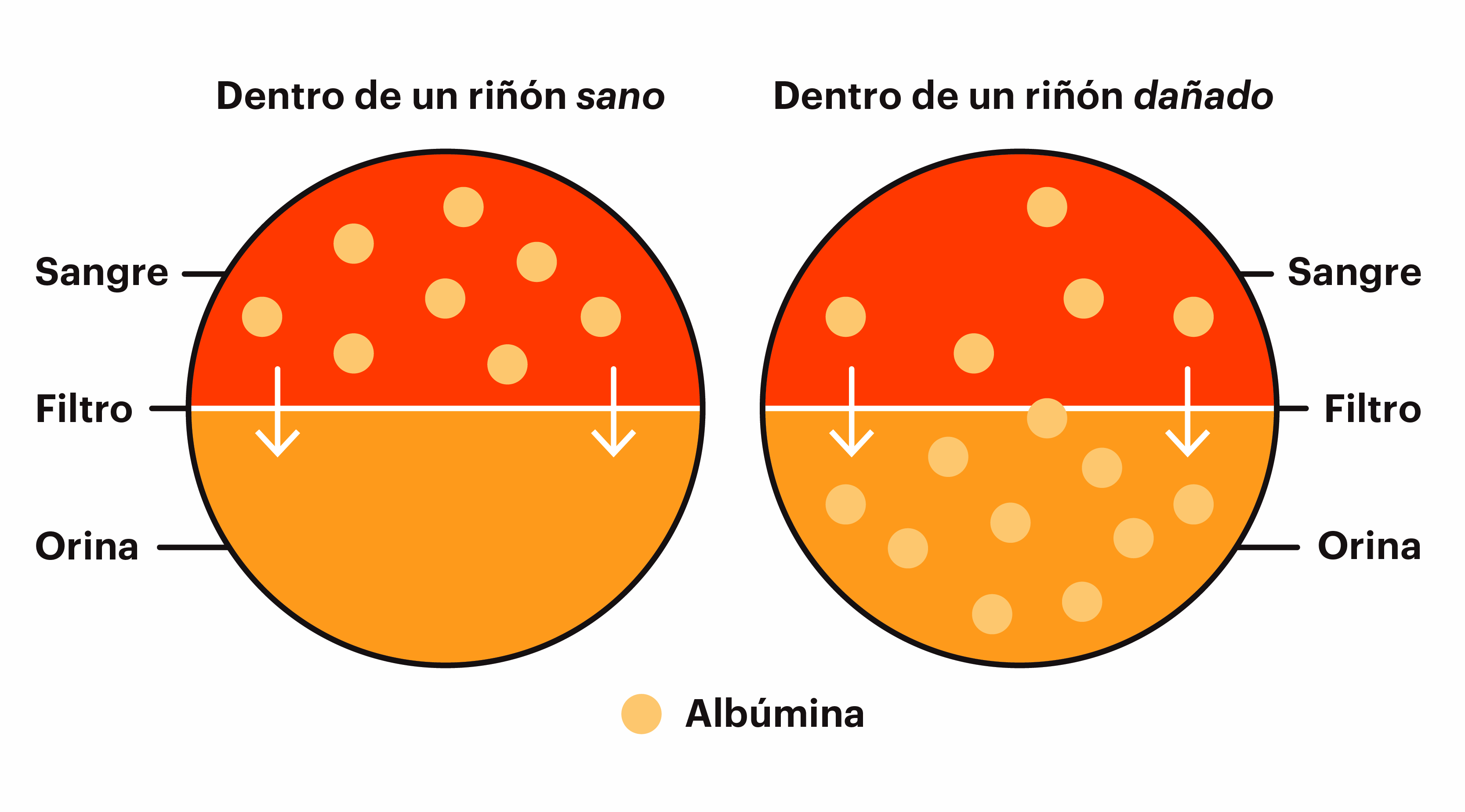 Imagen de filtración de un riñón sano y de un riñón dañado