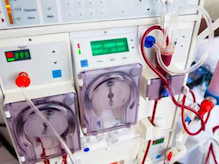 Close-up of dialysis machine