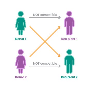 In paired exchange, an incompatible donor/recipient pair (incompatible blood types) are matched with another incompatible donor/recipient pair for a "swap". Each donor gives a kidney to the other person's intended recipient.