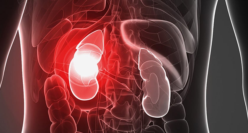 Renal Failure Academy, 13th Edition