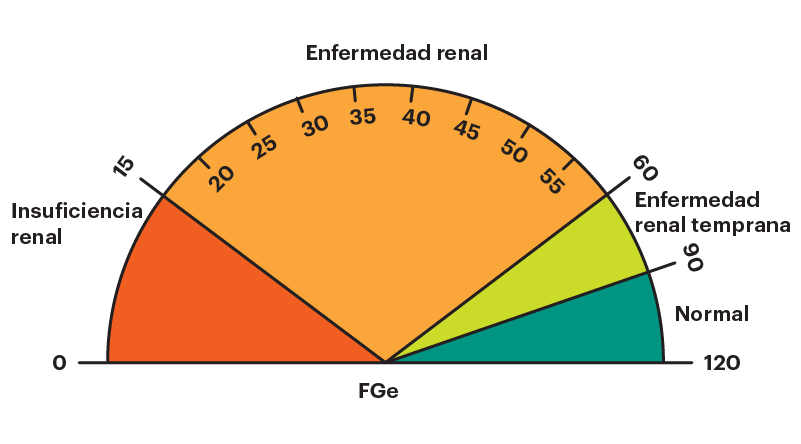 Un gráfico circular de un dial similar a un velocímetro que muestra resultados de FGe de 0 a 15 como insuficiencia renal, de 15 a 60 como enfermedad renal, de 60 a 90 como enfermedad renal en etapa inicial y de 90 a 120 como normal
