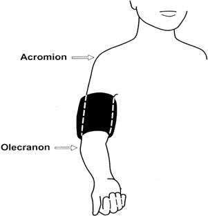 Finding the correct cuff size for measuring a child’s blood pressure. The cuff bladder should cover 80% to 100% of the circumference of the arm.