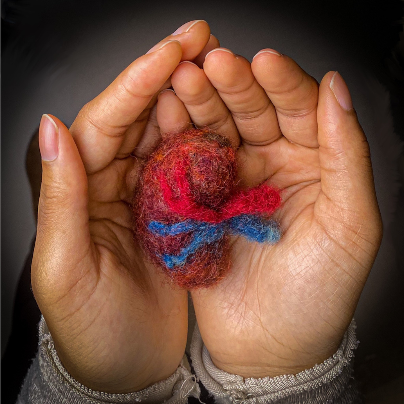  "Love Can Be Felt," 2022. Photograph of a Lupus patient's hands holding a felted kidney sculpture by Jess