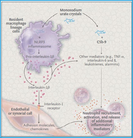 Pathophysiology of Gout: Mechanisms of Inflammation