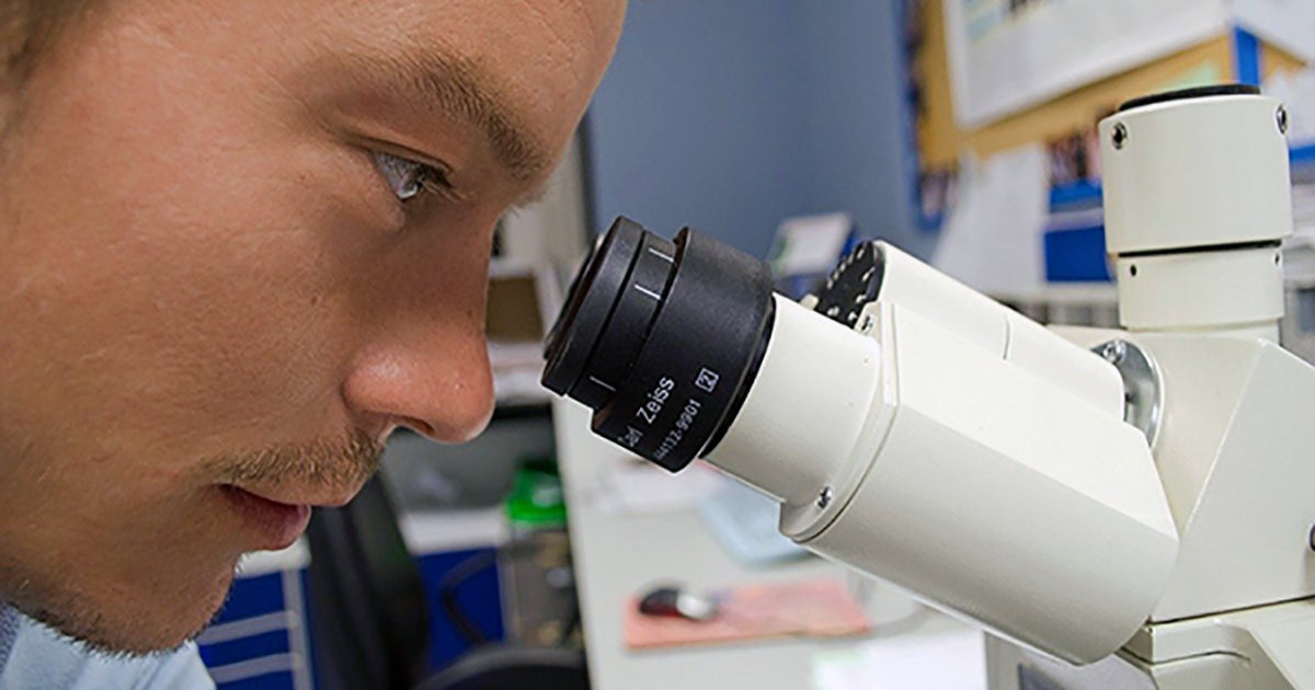 Study Reveals Possible Drug Treatment for Lupus Kidney Disease