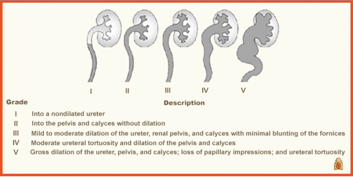 Vesicoureteral Reflux (VUR) Kidney Grading